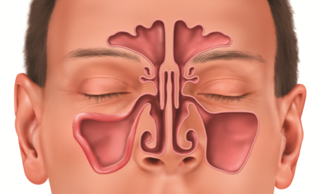 Chronic Sinusitis: An Overview of Sinus Surgery | Huntsville Ear, Nose ...